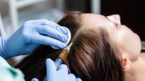 Мезотерапия для волос: красивые и здоровые волосы в ваших руках